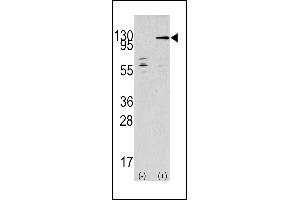 Western blot analysis of TAOK3 (arrow) using rabbit polyclonal TAOK3 Antibody (C-term) (ABIN390997 and ABIN2841175). (TAO Kinase 3 anticorps  (C-Term))
