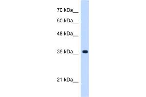 WB Suggested Anti-C19orf47 Antibody Titration:  0. (C19orf47 anticorps  (C-Term))