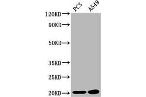 Western Blot Positive WB detected in: PC-3 whole cell lysate, A549 whole cell lysate All lanes: SNX12 antibody at 2.