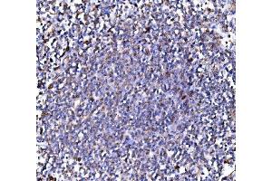 IHC analysis of PMPCA/INPP5 using anti-PMPCA/INPP5 antibody (ABIN7602722). (PMPCA anticorps  (AA 99-525))