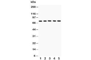 Western blot testing of 12 Lipoxygenase antibody and Lane 1:  A549 (12-Lipoxygenase anticorps  (C-Term))