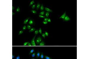 Immunofluorescence analysis of U2OS cells using PHC3 Polyclonal Antibody (PHC3 anticorps)