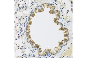 Immunohistochemistry of paraffin-embedded mouse lung using CRTAP antibody (ABIN5972488) at dilution of 1/100 (40x lens). (CRTAP anticorps)