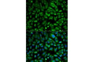 Immunofluorescence analysis of MCF7 cells using eIF4E antibody .