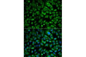Immunofluorescence analysis of MCF7 cells using eIF4E antibody . (EIF4E anticorps  (AA 1-217))