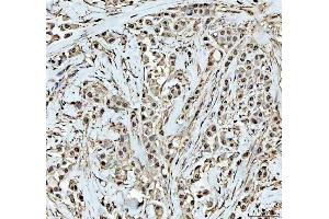 IHC analysis of DCK using anti-DCK antibody (ABIN5693016). (DCK anticorps  (AA 17-260))