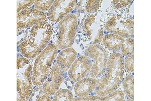 Immunohistochemistry of paraffin-embedded Rat kidney using MMP10 Polyclonal Antibody at dilution of 1:100 (40x lens). (MMP10 anticorps)