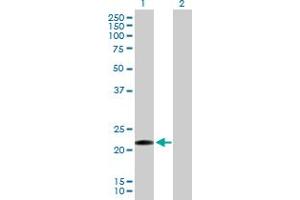 Western Blot analysis of CLEC1B expression in transfected 293T cell line by CLEC1B MaxPab polyclonal antibody.