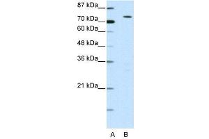 WB Suggested Anti-MYST2  Antibody Titration: 0.