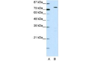 WB Suggested Anti-MYST2  Antibody Titration: 0. (MYST2 anticorps  (N-Term))