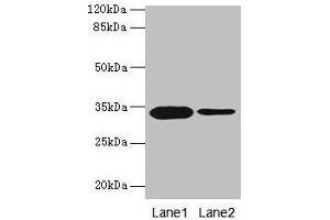 Western blot All lanes: OGN antibody at 14 μg/mL Lane 1: Rat liver tissue Lane 2: 293T whole cell lysate Secondary Goat polyclonal to rabbit IgG at 1/10000 dilution Predicted band size: 34 kDa Observed band size: 34 kDa (OGN anticorps  (AA 21-298))