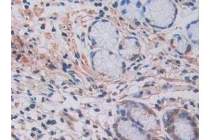 Detection of LOXL2 in Human Stomach Tissue using Polyclonal Antibody to Lysyl Oxidase Like Protein 2 (LOXL2)