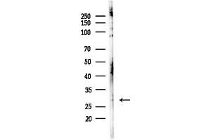 Western blot analysis of lysates from HepG2 cells(LPS,4h treatment), using CLEC4D Antibody at 1/1000 dilution.