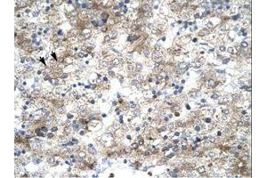 Image no. 2 for anti-General Transcription Factor IIH, Polypeptide 1, 62kDa (GTF2H1) (N-Term) antibody (ABIN202744)