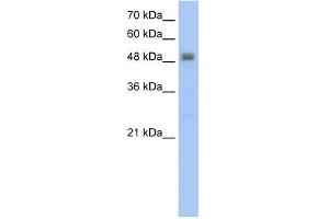 RSAD2 antibody used at 5 ug/ml to detect target protein. (RSAD2 anticorps  (C-Term))