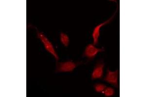 ABIN6275178 staining COLO205 by IF/ICC.