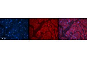 Rabbit Anti-SLC6A5 Antibody    Formalin Fixed Paraffin Embedded Tissue: Human Adult heart  Observed Staining: Cytoplasmic Primary Antibody Concentration: 1:600 Secondary Antibody: Donkey anti-Rabbit-Cy2/3 Secondary Antibody Concentration: 1:200 Magnification: 20X Exposure Time: 0. (SLC6A5 anticorps  (N-Term))