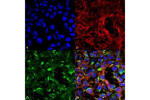 Immunocytochemistry/Immunofluorescence analysis using Mouse Anti-Dityrosine Monoclonal Antibody, Clone 7D4 (ABIN5067464). (Dityrosine anticorps  (HRP))