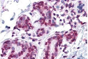 Human Breast: Formalin-Fixed, Paraffin-Embedded (FFPE)