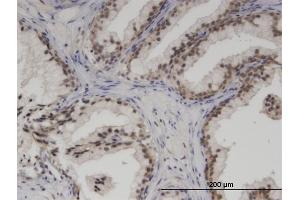 Immunoperoxidase of monoclonal antibody to SMARCA5 on formalin-fixed paraffin-embedded human prostate.