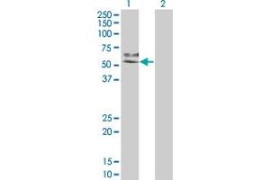 Western Blot analysis of MAP2K7 expression in transfected 293T cell line by MAP2K7 monoclonal antibody (M04), clone 2G5.