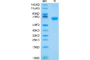 Biotinylated Human 4-1BB on Tris-Bis PAGE under reduced condition.