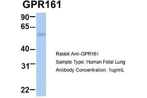 Host:  Rabbit  Target Name:  GPR161  Sample Type:  Human Fetal Lung  Antibody Dilution:  1.