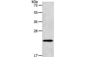 Western Blot analysis of Human liver cancer tissue using NEUROG1 Polyclonal Antibody at dilution of 1:400 (Neurogenin 1 anticorps)