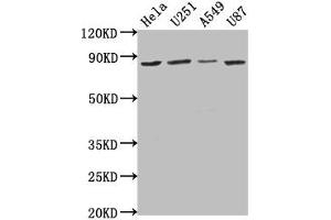 Western Blot Positive WB detected in: Hela whole cell lysate, U251 whole cell lysate, A549 whole cell lysate, U87 whole cell lysate All lanes: VPS51 antibody at 1:1000 Secondary Goat polyclonal to rabbit IgG at 1/50000 dilution Predicted band size: 87, 73 kDa Observed band size: 87 kDa (VPS51 anticorps  (AA 595-673))