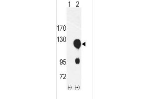 Western blot analysis of ROR2 using rabbit polyclonal ROR2 Antibody using 293 cell lysates (2 ug/lane) either nontransfected (Lane 1) or transiently transfected with the ROR2 gene (Lane 2). (ROR2 anticorps  (N-Term))