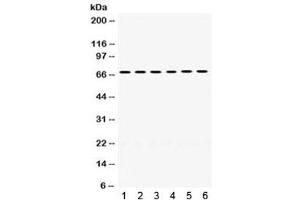 Western blot testing of 1) rat liver, 2) rat lung, 3) mouse liver, 4) mouse lung, 5) human COLO320 and 6) human MCF7 lysate with PDPK1 antibody. (PDPK1 anticorps)