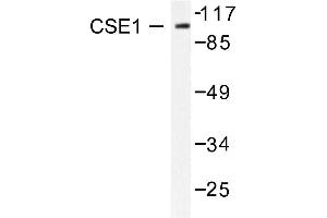 Image no. 2 for anti-CSE1 Chromosome Segregation 1-Like (CSE1L) antibody (ABIN265374) (Exportin 2 anticorps)