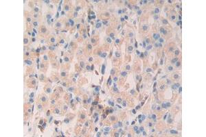Used in DAB staining on fromalin fixed paraffin- embedded Kidney tissue