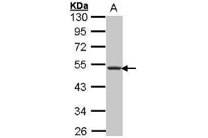 WB Image Sample (30 ug of whole cell lysate) A: Hep G2 , 10% SDS PAGE antibody diluted at 1:1000 (CXCR5 anticorps)