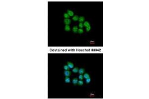 ICC/IF Image Immunofluorescence analysis of paraformaldehyde-fixed A431, using MBNL3, antibody at 1:200 dilution. (MBNL3 anticorps)