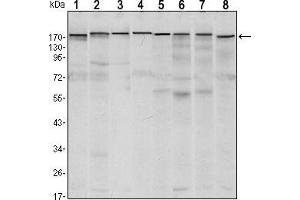 Western blot analysis using SETDB1 mouse mAb against MCF-7 (1),T47D (2), HEK293 (3), JURKAT (4), NIH/3T3 (5), F9 (6), RAW246. (SETDB1 anticorps)