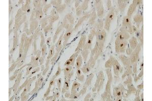 Immunoperoxidase of monoclonal antibody to TTN on formalin-fixed paraffin-embedded human heart.
