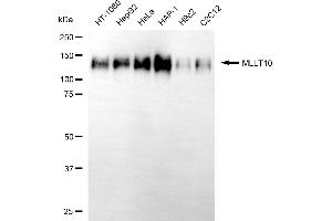 anti-Protein AF-10 (MLLT10) antibody