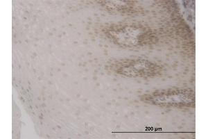 Immunoperoxidase of monoclonal antibody to FOXO3A on formalin-fixed paraffin-embedded human esophagus.