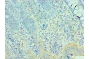 Immunohistochemistry of paraffin-embedded human epityphlon tissue using ABIN7160627 at dilution of 1:100