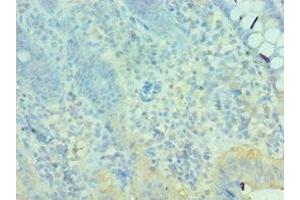 Immunohistochemistry of paraffin-embedded human epityphlon tissue using ABIN7160627 at dilution of 1:100 (MTM1 anticorps  (AA 484-603))