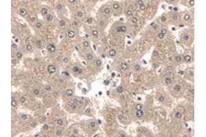 Detection of CK2 in Human Liver Tissue using Polyclonal Antibody to Keratin 2 (CK2)