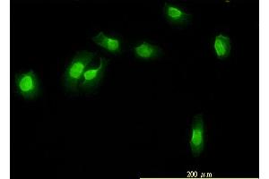 Immunofluorescence of monoclonal antibody to WDR61 on HeLa cell. (WDR61 anticorps  (AA 1-305))