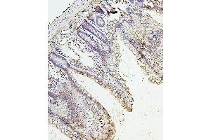 IHC analysis of H1F0 using anti-H1F0 antibody (ABIN7600521). (Histone H1 anticorps  (AA 20-159))