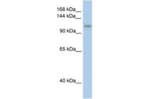 Western Blotting (WB) image for anti-PRP6 Pre-mRNA Processing Factor 6 Homolog (PRPF6) antibody (ABIN2462244) (PRP6/ANT-1 anticorps)