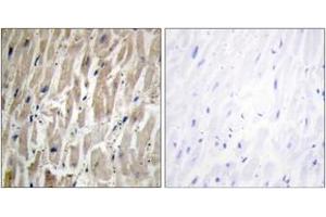 Immunohistochemistry (Paraffin-embedded Sections) (IHC (p)) image for anti-Cytochrome P450, Family 2, Subfamily J, Polypeptide 2 (CYP2J2) (AA 231-280) antibody (ABIN2889947)