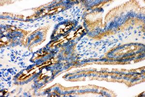 Anti- gamma Catenin Picoband antibody, IHC(P) IHC(P): Mouse Intestine Tissue (JUP anticorps  (AA 556-745))
