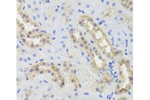 Immunohistochemistry of paraffin-embedded Rat kidney using DISC1 Polyclonal Antibody at dilution of 1:100 (40x lens).