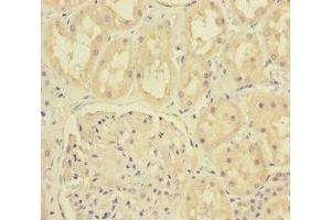 Immunohistochemistry of paraffin-embedded human kidney tissue using ABIN7165835 at dilution of 1:100 (MTO1 anticorps  (AA 420-680))
