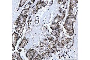 IHC analysis of MBNL1 using anti-MBNL1 antibody (ABIN7602608). (MBNL1 anticorps  (AA 89-388))
